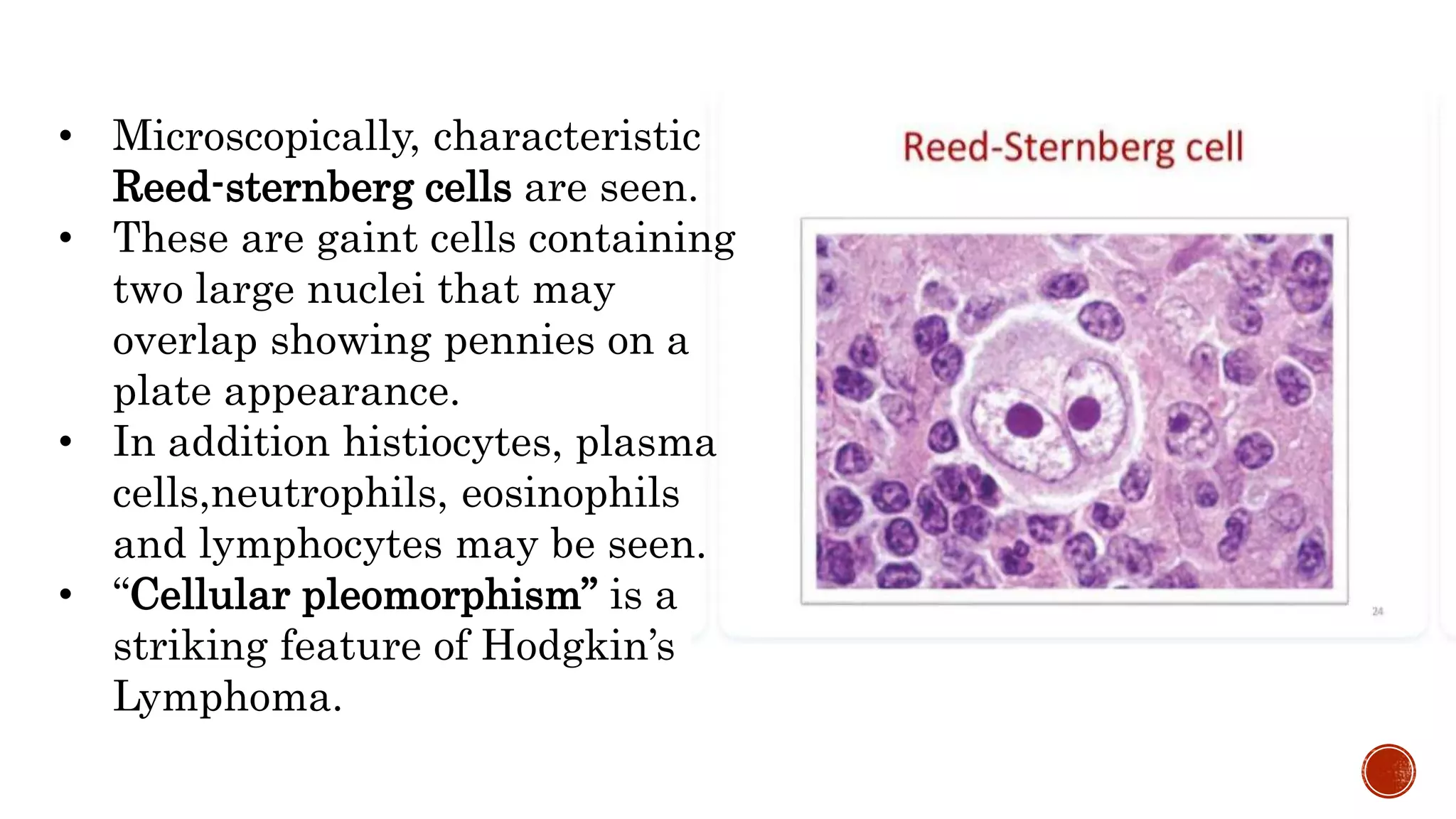 Penny With Reed hodgkin's lymphoma.pptx