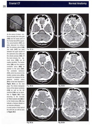 Hofer ct teaching manual - a systematic approach to ct reading, 2nd ed ...