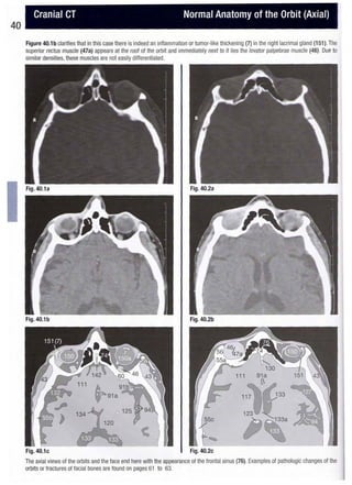 Hofer ct teaching manual - a systematic approach to ct reading, 2nd ed ...