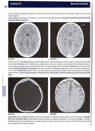 Hofer ct teaching manual - a systematic approach to ct reading, 2nd ed ...