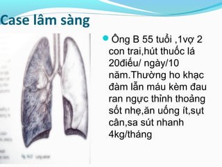 Case lâm sàng
Ông B 55 tuổi ,1vợ 2
con trai,hút thuốc lá
20điếu/ ngày/10
năm.Thường ho khạc
đàm lẫn máu kèm đau
ran ngực thỉnh thoảng
sốt nhẹ,ăn uống ít,sụt
cân,sa sút nhanh
4kg/tháng
 