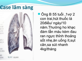 Case lâm sàng
Ông B 55 tuổi ,1vợ 2
con trai,hút thuốc lá
20điếu/ ngày/10
năm.Thường ho khạc
đàm lẫn máu kèm đau
ran ngực thỉnh thoảng
sốt nhẹ,ăn uống ít,sụt
cân,sa sút nhanh
4kg/tháng
 
