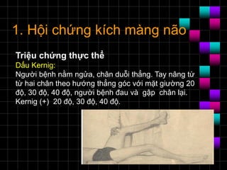 1. Hội chứng kích màng não
Triệu chứng thực thể
Dấu Kernig:
Người bệnh nằm ngửa, chân duỗi thẳng. Tay nâng từ
từ hai chân theo hướng thẳng góc với mặt giường 20
độ, 30 độ, 40 độ, người bệnh đau và gập chân lại.
Kernig (+) 20 độ, 30 độ, 40 độ.
 