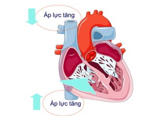 Áp lực tăng
Áp lực tăng
 