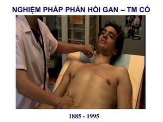 NGHIỆM PHÁP PHẢN HỒI GAN – TM CỔ
1885 - 1995
 