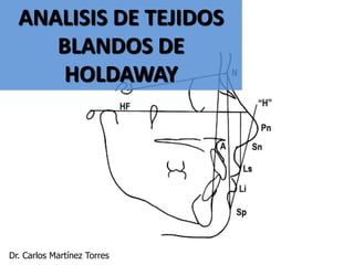 ANALISIS DE TEJIDOS
     BLANDOS DE
      HOLDAWAY




Dr. Carlos Martínez Torres
 