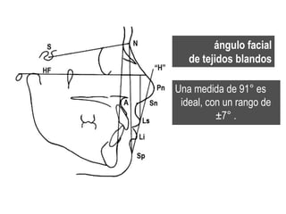 ángulo facial
   de tejidos blandos

Una medida de 91° es
 ideal, con un rango de
          ±7° .
 