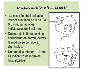 9.- Labio inferior a la línea de H
• La posición ideal del labio
  inferior a la línea de H es 0 a
  0,5 mm, variaciones
  individuales de 1 a 2 mm.
• Delante de la línea de H se
  consideran en norma, detrás,
  la medida se considera
  disminuida.
• Una medida inferior a -1 mm.
  es indicativo de incisivos
  lingualizados
 