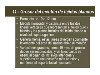 11.- Grosor del mentón de tejidos blandos
  • Promedio de 10 a 12 mm
  • Medida horizontal y distancia entre las dos
    líneas verticales que representan el tejido duro -
    blando y los planos faciales del tejido blando a
    nivel del suprapogonion
  • Generalmente, estas líneas divergen solamente
    levemente del área del nasion abajo al mentón.
  • Variaciones grandes, como 19 mm. de grueso
    deben ser reconocidas, y en tales casos es
    esencial dejar los incisivos inferiores y
    superiores en una posición más anterior y
    mantener el soporte labial necesario.
 