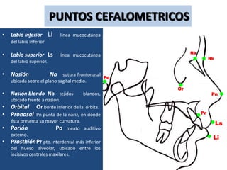 PUNTOS CEFALOMETRICOS
•   Labio inferior        Li   línea mucocutánea
    del labio inferior

                                                          Na
•   Labio superior Ls          línea mucocutánea
                                                                    Nb
    del labio superior.

• Nasión                  Na sutura frontonasal
                                                Po
    ubicada sobre el plano sagital medio.
                                                     Or
•   Nasión blando Nb tejidos            blandos,                     Pn
    ubicado frente a nasión.
•   Orbital Or borde inferior de la órbita.
• Pronasal       Pn punta de la nariz, en donde                Pr
    ésta presenta su mayor curvatura.
                                                                         Ls
•   Porión                Po meato auditivo
    externo.
                                                                     Li
•   ProsthiónPr pto. nterdental más inferior
    del hueso alveolar, ubicado entre los
    incisivos centrales maxilares.
 