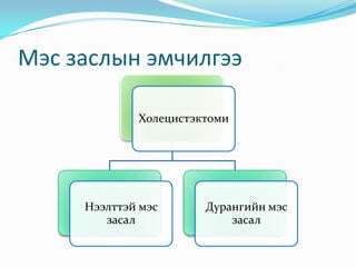 Мэс заслын эмчилгээ
Холецистэктоми
Нээлттэй мэс
засал
Дурангийн мэс
засал
 