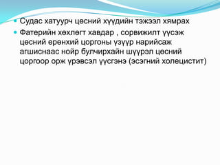  Судас хатуурч цөсний хүүдийн тэжээл хямрах
 Фатерийн хөхлөгт хавдар , сорвижилт үүсэж
цөсний ерөнхий цоргоны үзүүр нарийсаж
агшиснаас нойр булчирхайн шүүрэл цөсний
цоргоор орж үрэвсэл үүсгэнэ (эсэгний холецистит)
 