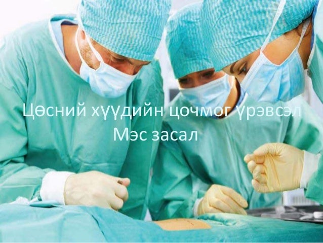 Холецистит