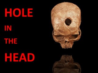 HOLE   IN THE HEAD 
