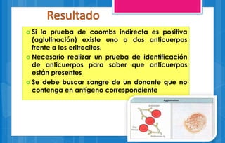  Si la prueba de coombs indirecta es positiva 
(aglutinación) existe uno o dos anticuerpos 
frente a los eritrocitos. 
 Necesario realizar un prueba de identificación 
de anticuerpos para saber que anticuerpos 
están presentes 
 Se debe buscar sangre de un donante que no 
contenga en antígeno correspondiente 
 