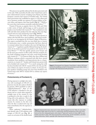©2013LandesBioscience.Donotdistribute.
www.landesbioscience.com	Dermato-Endocrinology	 53
This process was quickly embraced by the dairy processors and
in the early 1930s essentially all milk in the United States and in
most industrialized countries including Great Britain and other
European countries had vitamin D fortified milk. The United
States government also established an agency in 1931 whose goal
was to promote sensible sun exposure of young children to pre-
vent rickets and improve their bone health (Fig. 8).9,14
Within a
few years these interventions essentially eradicated rickets.8,17-19
Vitamin D became so popular that in the 1930s and 1940s
a wide variety of foods and beverages as well as personal care
products were fortified with vitamin D.19
They included not only
milk and other dairy products but also soda pop, beer, hot dogs,
custard and even soap and shaving cream (Figs. 9A-D).19
However in the early 1950s an outbreak of hypercalcemia in
infants who had elfin faces, heart problems, and mental retarda-
tion led to an investigation by the Royal College of Physicians.
The experts concluded that this was most likely due to vitamin
D intoxication since a similar presentation had been observed
in neonatal rodents born of mothers who were fed high doses of
vitamin D.20-22
Legislation quickly followed banning the fortifi-
cation of any food or personal use products with vitamin D in
Great Britain.8,17,22
This ban quickly spread across Europe and
for the most part remains in effect today with the exception of a
few foods including margarine and some cereals being fortified
with vitamin D.8,19-22
It is however likely that these children had
Williams syndrome which is associated with elfin faces, mental
retardation, heart problems, and hypercalcemia due to a hyper-
sensitivity to vitamin D.23
Sweden and Finland now permit milk
to be fortified with vitamin D.22,24
It is worth noting that milk
has been fortified with 100 IU vitamin D/8 oz for the past 80+
years without any reports of toxicity in infants. In the past 10 y
juice products including orange juice have been fortified in the
United States with 100 IU vitamin D/8 oz without any reports
of toxicity.22
Photochemistry of Provitamin D3
During exposure to sunlight solar radia-
tion with wavelengths of 290–315 nm
penetrate into the skin and are absorbed
by proteins, DNA and RNA as well as
7-dehydrocholesterol.1,2
Most of this
UVB radiation is absorbed in the epi-
dermis and as a result when exposed to
sunlight most of the vitamin D3
that
is produced in the skin is made in the
living cells in the epidermis. This is the
reason why after exposure to sunlight
vitamin D3
remains in the skin even
when the skin is washed with soap and
water immediately after the exposure to
sunlight.
When epidermal 7-dehydrocholes-
terol absorbs solar UVB radiation with
energies of 290–315 nm (Fig. 10), it
causes an activation of the double bonds
Figure 3. Photograph from Glasgow, Great Britain, in about 1870 show-
ing that the buildings are built in close proximity to each other. Holick,
copyright 1994. Reproduced with permission.
Figure 4. Skeletal deformities observed in rickets. (A) Photograph from the 1930s of a sister (left)
and brother (right), aged 10 mo and 2.5 y, respectively, showing enlargement of the ends of the
bones at the wrist, carpopedal spasm, and a typical “Taylorwise” posture of rickets. (B) The same
brother and sister 4 y later, with classic knock-knees and bow legs, growth retardation, and other
skeletal deformities. Holick, copyright 2006. Reproduced with permission.
 