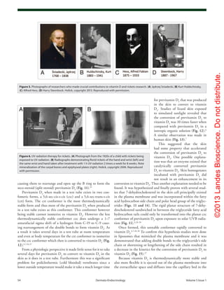 ©2013LandesBioscience.Donotdistribute.
54	 Dermato-Endocrinology	Volume 5 Issue 1
for previtamin D3
that was produced
in the skin to convert to vitamin
D3
. Studies of lizard skin exposed
to simulated sunlight revealed that
the conversion of previtamin D3
to
vitamin D3
was 10 times faster when
compared with previtamin D3
in a
isotropic organic solution (Fig. 12).6
A similar observation was made in
human skin (Fig. 13).7
This suggested that the skin
had some property that accelerated
the conversion of previtamin D3
to
vitamin D3
. One possible explana-
tion was that an enzyme existed that
catalytically converted previtamin
D3
to vitamin D3
. Skin homogenates
incubated with previtamin D3
did
not result in an enhancement in its
conversion to vitamin D3
. Thus another explanation needed to be
found. It was hypothesized and finally proven with several stud-
ies that 7-dehydrocholesterol in the skin cell principally existed
in the plasma membrane and was incorporated within the fatty
acid hydrocarbon side chain and polar head group of the triglyc-
erides (Figs. 11 and 14). The rigid planar structure of 7-dehy-
drocholesterol sandwiched in between the triglyceride fatty acid
hydrocarbon tails could only be transformed into the planar czc
conformer of previtamin D3
upon exposure to solar UVB radia-
tion (Fig. 11).6,26-28
Once formed, this unstable conformer rapidly converted to
vitamin D3
.6,7,26-28
To confirm this hypothesis studies were done
in liposomes that mimicked the plasma membrane and it was
demonstrated that adding double bonds to the triglyceride’s side
chain or shortening or lengthening of the side chain resulted in
a decrease in the kinetics for the conversion of previtamin D3
to
vitamin D3
(Fig. 15).27
Because vitamin D3
is thermodynamically more stable and
also more flexible it is ejected out of the plasma membrane into
the extracellular space and diffuses into the capillary bed in the
causing them to rearrange and open up the B ring to form the
seco-steroid (split steroid) previtamin D3
(Fig. 11).25
Previtamin D3
when made in a test tube exists in two con-
fomeric forms, a 5,6-sec-cis-s-cis (czc) and a 5,6-sec-trans-s-cis
(czt) form. The czt conformer is the most thermodynamically
stable form and thus most of the previtamin D3
when produced
in a test tube exists as this conformer. This conformer however
being stable cannot isomerize to vitamin D3
. However the less
thermodynamically stable conformer czc does undergo a 1–7
antarafacial sigma shift of a hydrogen from C-19 to C-9 caus-
ing rearrangement of the double bonds to form vitamin D3
. As
a result it takes several days in a test tube at room temperature
and even at body temperature for the czt conformer to isomerize
to the czc conformer which then is converted to vitamin D3
(Fig.
12).6,7,26,27
From a physiologic perspective it made little sense for it to take
several days for previtamin D3
to convert to vitamin D3
in the
skin as it does in a test tube. Furthermore this was a significant
problem for poikilothermic (cold blooded) vertebrates since a
lower outside temperature would make it take a much longer time
Figure 5. Photographs of researchers who made crucial contributions to vitamin D and rickets research. (A) Jędrzej Sniadecki, (B) Kurt Huldschinsky,
(C) Alfred Hess, (D) Harry Steenbock. Holick, copyright 2013. Reproduced with permission.
Figure 6. UV radiation therapy for rickets. (A) Photograph from the 1920s of a child with rickets being
exposed to UV radiation. (B) Radiographs demonstrating florid rickets of the hand and wrist (left) and
the same wrist and hand taken after treatment with 1 h UV radiation 2 times a week for 8 weeks. Note
mineralization of the carpal bones and epiphyseal plates (right). Holick, copyright 2006. Reproduced
with permission.
 