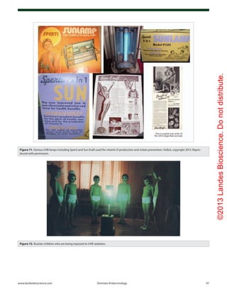 ©2013LandesBioscience.Donotdistribute.
www.landesbioscience.com	Dermato-Endocrinology	 97
Figure 71. Various UVB lamps including Sperti and Sun Kraft used for vitamin D production and rickets prevention. Holick, copyright 2013. Repro-
duced with permission.
Figure 72. Russian children who are being exposed to UVB radiation.
 