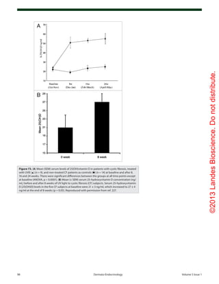 ©2013LandesBioscience.Donotdistribute.
98	 Dermato-Endocrinology	Volume 5 Issue 1
Figure 73. (A) Mean (SEM) serum levels of 25(OH)vitamin D in patients with cystic fibrosis, treated
with UVB (▲) (n = 9), and non-treated CF patients as controls (●) (n = 14) at baseline and after 8,
16 and 24 weeks. There were significant differences between the groups at all time points except
at baseline (ANOVA, p < 0.0001). (B) Mean (± SEM) serum 25-hydroxyvitamin D concentration (ng/
mL) before and after 8 weeks of UV light to cystic fibrosis (CF) subjects. Serum 25-hydroxyvitamin
D [25(OH)D] levels in the five CF subjects at baseline were 21 ± 3 ng/ml, which increased to 27 ± 4
ng/ml at the end of 8 weeks (p = 0.05). Reproduced with permission from ref. 227.
 