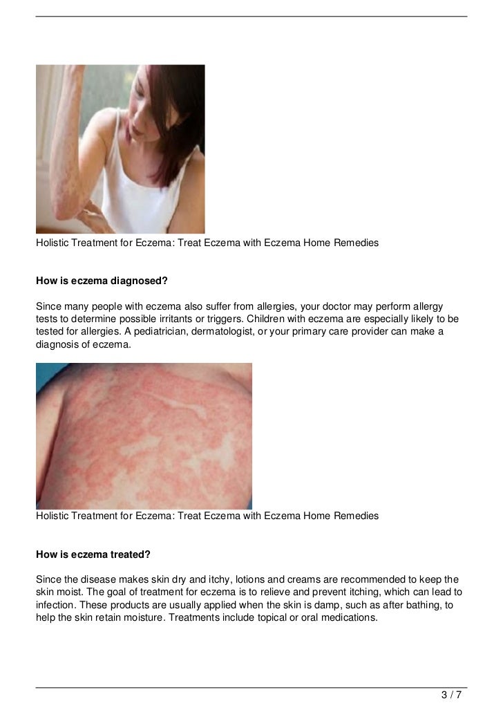 Holistic Treatment for Eczema Treat Eczema with Eczema Home Remedies