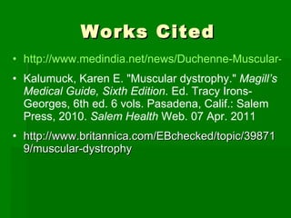 Works Cited http://www.medindia.net/news/Duchenne-Muscular-Dystrophy-is-Ultimately-a-Stem-Cell-Disease-77907-1.htm Kalumuck, Karen E. &quot;Muscular dystrophy.&quot;  Magill’s Medical Guide, Sixth Edition . Ed. Tracy Irons-Georges, 6th ed. 6 vols. Pasadena, Calif.: Salem Press, 2010.  Salem Health  Web. 07 Apr. 2011   http://www.britannica.com/EBchecked/topic/398719/muscular-dystrophy 