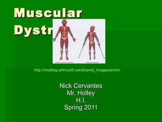 Muscular Dystrophy Nick Cervantes Mr. Holley H.I. Spring 2011 http://moblog.whmsoft.net/shared_images/en/image003_2999b163b7841f6de94f4ac872d23d48.jpg 