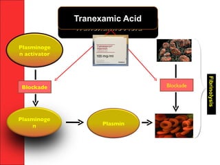 ACEM ASM 2010
Plasminoge
n activator
Plasmin
Plasminoge
n
Blockade Blockade
Tranexamic AcidTranexamic Acid
Tranexamic AcidTranexamic Acid
Fibrinolysis
 