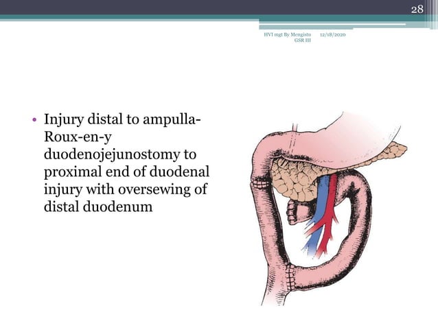 Hollow viscus injury management | PPTX | Death, Injury, or Military ...