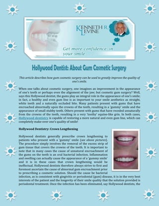 This article describes how gum cosmetic surgery can be used to greatly improve the quality of
                                        one’s smile.

When one talks about cosmetic surgery, one imagines an improvement in the appearance
of one’s teeth or perhaps even the alignment of the jaw; but cosmetic gum surgery? Well,
says this Hollywood dentist, the gums play an integral role in the appearance of one’s smile;
in fact, a healthy and even gum line is as important to your smile aesthetics as straight,
white teeth and a naturally occluded bite. Many patients present with gums that have
encroached abnormally upon the crowns of the teeth, resulting in a ‘gummy’ smile and the
appearance of small stubby teeth. Others present with gums that have receded unnaturally
from the crowns of the teeth, resulting in a very ‘toothy’ equine-like grin. In both cases,
Hollywood dentistry is capable of restoring a more natural and even gum line, which can
completely make-over one’s quality of smile!

Hollywood Dentistry: Crown Lengthening

Hollywood dentists generally prescribe crown lengthening to
patients who present with a ‘gummy’ smile (see above pictures).
The procedure simply involves the removal of the excess strip of
gum tissue that covers the crowns of the teeth. It is important to
note that in many cases the cause of unnatural encroachment of
the gums on the teeth is an oral bacterial infection. Inflammation
and swelling can actually cause the appearance of a ‘gummy smile’
and it is in these cases that crown lengthening would be
ineffectual. Hollywood dentists therefore always strive to first and
foremost ascertain the cause of abnormal gum encroachment prior
to prescribing a cosmetic solution. Should the cause be bacterial
infection, as is consistent with gingivitis or periodontal (gum) disease, it is in the very best
interests of the patient and the longevity of their smile quality that the solution provided is
periodontal treatment. Once the infection has been eliminated, say Hollywood dentists, the
 