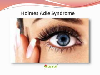 Holmes Adie Syndrome
 