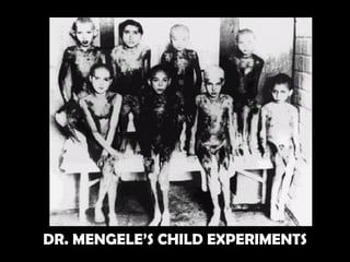 DR. MENGELE’S CHILD EXPERIMENTS 