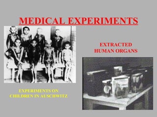 MEDICAL EXPERIMENTS EXTRACTED HUMAN ORGANS EXPERIMENTS ON CHILDREN IN AUSCHWITZ 