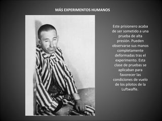       MÁS EXPERIMENTOS HUMANOS   Este prisionero acaba de ser sometido a una prueba de alta presión. Pueden observarse sus manos completamente deformadas tras el experimento. Esta clase de pruebas se aplicaban para favorecer las condiciones de vuelo de los pilotos de la Luftwaffe.  