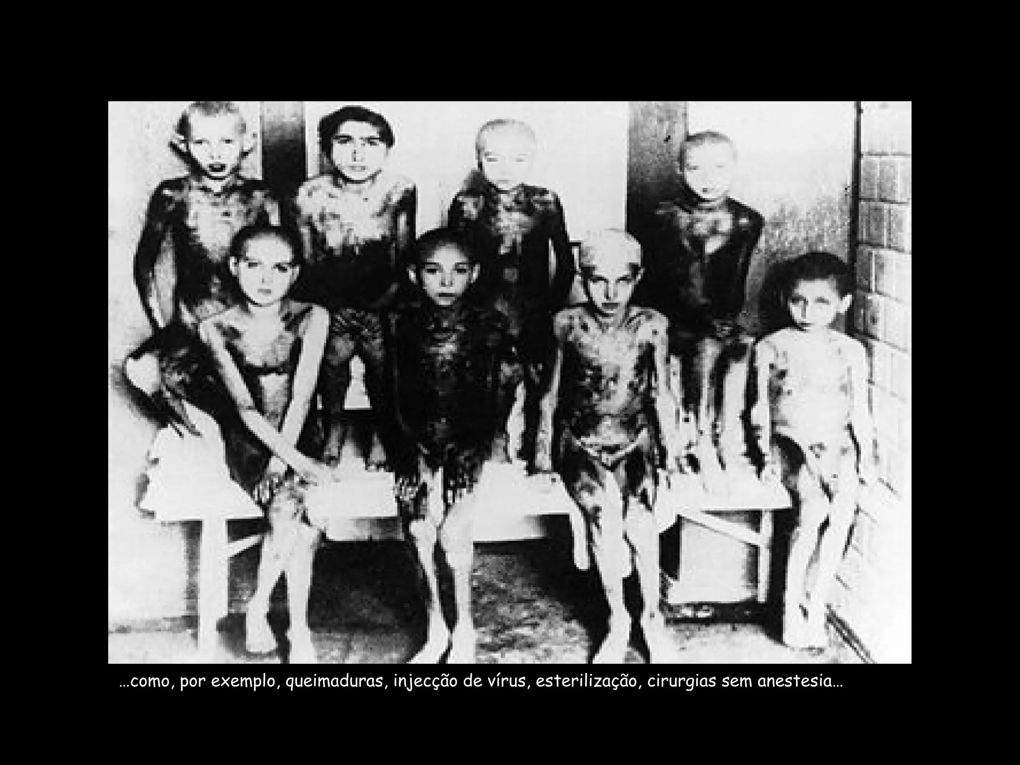 … como, por exemplo, queimaduras, injecção de vírus, esterilização, cirurgias sem anestesia… 