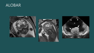 ALOBAR
 