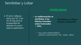 Semilobar y Lobar
 El único hallazgo
obvio por US a las
18-20 sdg sería la
incapacidad de
detectar el cavum
septum pellucidum.
• La malformación es
semilobar si los
lóbulos frontales
están fusionados
> 50%.
• Hoz y fisura interhemisférica
posterior y parte posterior del cuerpo calloso
Hipotálamo y tálamo
siempre fusionados
SEMILOBAR
 