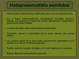 Holoprosencefalia semilobar
• Diferenciación parcial de los ventrículos pero con una cámara única.
• Hoz y fisura interhem...