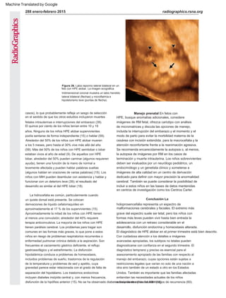 Manejo prenatal En fetos con
HPE, busque anomalías adicionales, considere
imágenes de RM fetal, ofrezca cariotipo con análisis
de micromatrices y discuta las opciones de manejo,
incluida la interrupción del embarazo y el momento y el
modo de parto para evitar la morbilidad materna de la
cesárea con incisión extendida. para la macrocefalia y la
atención reconfortante frente a la reanimación agresiva.
Se recomienda encarecidamente la autopsia o, al menos,
la autopsia de imágenes por RM en los casos de
terminación y muerte intrauterina. Los niños sobrevivientes
deben ser evaluados por un neurólogo pediátrico, un
endocrinólogo y un genetista clínico y someterse a
imágenes de alta calidad en un centro de derivación
dedicado para definir con mayor precisión la anormalidad
cerebral. También se puede considerar la posibilidad de
incluir a estos niños en las bases de datos mantenidas
en centros de investigación como los Centros Carter.
Conclusión La
holoprosencefalia representa un espectro de
malformaciones cerebrales y faciales. El extremo más
grave del espectro suele ser letal, pero los niños con
formas más leves pueden vivir hasta bien entrada la
adolescencia con un retraso considerable en el
desarrollo, disfunción endocrina y homeostasis alterada.
El diagnóstico de HPE alobar en el primer trimestre está bien descrito.
radiographics.rsna.org
288 enero-febrero 2015
un quiste dorsal está presente. Se colocan
derivaciones de líquido cefalorraquídeo en
aproximadamente el 17 % de los supervivientes (15).
Aproximadamente la mitad de los niños con HPE tienen
al menos una convulsión; alrededor del 40% requiere
terapia anticonvulsiva. La mayoría de los niños con HPE
tienen parálisis cerebral. Los problemas para tragar son
comunes en las formas más graves, lo que pone a estos
niños en riesgo de problemas respiratorios recurrentes o
enfermedad pulmonar crónica debido a la aspiración. Son
frecuentes el vaciamiento gástrico deficiente, el reflujo
gastroesofágico y el estreñimiento. La disfunción
hipotalámica conduce a problemas de homeostasis,
incluidos problemas de sueño, trastornos de la regulación
de la temperatura y problemas de sed y apetito, cuya
gravedad parece estar relacionada con el grado de falta de
separación del hipotálamo. Los trastornos endocrinos
incluyen diabetes insípida central y, con menos frecuencia,
disfunción de la hipófisis anterior (15). No se ha observado diabetes insípida en niños con MIH (18).
casos), lo que probablemente refleja un sesgo de selección
en el sentido de que los otros estudios incluyeron muertes
fetales intrauterinas e interrupciones del embarazo (39).
El quince por ciento de los niños tenían entre 10 y 19
años. Ninguno de los niños HPE alobar supervivientes
podía sentarse de forma independiente (15) o hablar (59).
Alrededor del 50% de los niños con HPE alobar mueren
a los 5 meses, pero hasta el 30% vive más allá del año
(59). Más del 50% de los niños con HPE semilobar o lobar
estaban vivos al año de edad (9). De aquellos con HPE
lobar, alrededor del 50% pueden caminar (algunos requieren
ayuda), tienen una función de la mano de normal a
levemente afectada y pueden hablar palabras sueltas
(algunos hablan en oraciones de varias palabras) (15). Los
niños con MIH pueden deambular con asistencia y hablar y
funcionar con un deterioro leve (39); el resultado del
desarrollo es similar al del HPE lobar (18).
Con cuidadosa atención a los detalles e imágenes
avanzadas apropiadas, los subtipos no letales pueden
diagnosticarse con confianza en el segundo trimestre. El
diagnóstico temprano y preciso es esencial para el
asesoramiento apropiado de las familias con respecto al
manejo del embarazo, cuyas opciones están sujetas a
restricciones legales que varían no solo de una nación a
otra sino también de un estado a otro en los Estados
Unidos. También es importante que las familias afectadas
entiendan las necesidades actuales de los niños
sobrevivientes y los futuros riesgos de recurrencia (60).
La hidrocefalia es común, particularmente cuando
Figura 26. Labio leporino lateral bilateral en un
feto con HPE alobar. La imagen ecográfica
tridimensional coronal muestra un labio hendido
lateral bilateral (flechas) y microftalmía e
hipotelorismo leve (puntas de flecha).
Machine Translated by Google
 