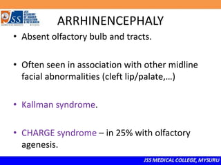 ARRHINENCEPHALY
• Absent olfactory bulb and tracts.
• Often seen in association with other midline
facial abnormalities (cleft lip/palate,…)
• Kallman syndrome.
• CHARGE syndrome – in 25% with olfactory
agenesis.
 