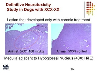 Definitive Neurotoxicity
Study in Dogs with XCX-XX
Lesion that developed only with chronic treatment

Animal 5XX1 100 mg/kg

Animal 5XX9 control

Medulla adjacent to Hypoglossal Nucleus (40X; H&E)
36

 