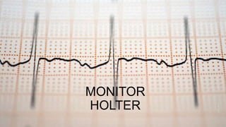 MONITOR
HOLTER
Sample
Footer
Text
4/24/2023
1
 