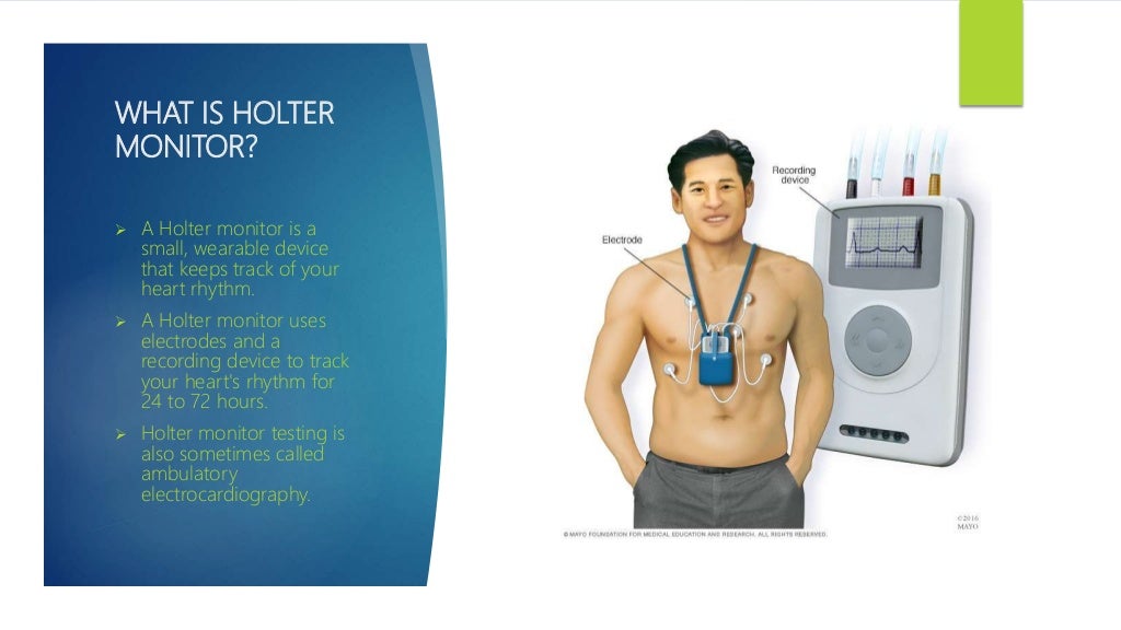 Holter monitoring
