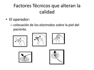 Factores Técnicos que alteran la
                calidad
• El operador:
  – colocación de los electrodos sobre la piel del
    paciente.
 