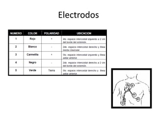 Electrodos
 