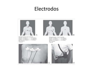 Electrodos
 