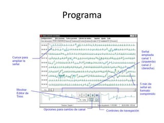 Programa
 