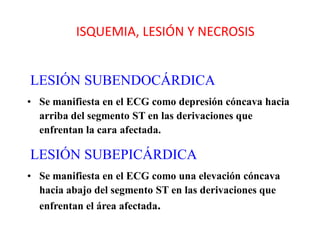 ISQUEMIA, LESIÓN Y NECROSIS


LESIÓN SUBENDOCÁRDICA
• Se manifiesta en el ECG como depresión cóncava hacia
  arriba del segmento ST en las derivaciones que
  enfrentan la cara afectada.

LESIÓN SUBEPICÁRDICA
• Se manifiesta en el ECG como una elevación cóncava
  hacia abajo del segmento ST en las derivaciones que
  enfrentan el área afectada.
 