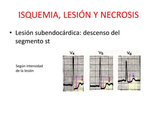 ISQUEMIA, LESIÓN Y NECROSIS
• Lesión subendocárdica: descenso del
  segmento st


  Según intensidad
  de la lesión
 