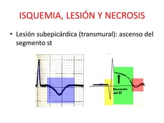ISQUEMIA, LESIÓN Y NECROSIS
• Lesión subepicárdica (transmural): ascenso del
  segmento st
 