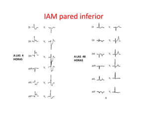 IAM pared inferior



A LAS 4            A LAS 48
HORAS              HORAS
 